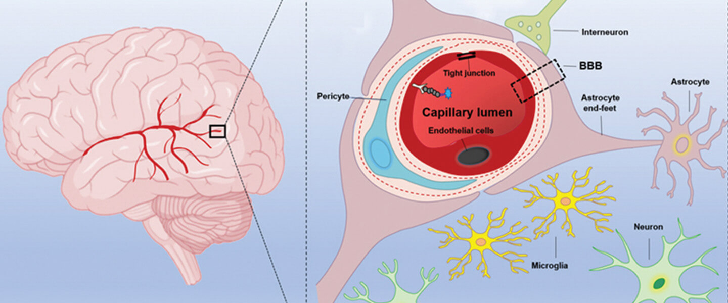 Illustration of BBB Disruption and Microglia Activation An illustration demonstrating spike proteins influence on Endothelial damage, BBB disruption, microglial and astrocyte activation, and neuronal damage