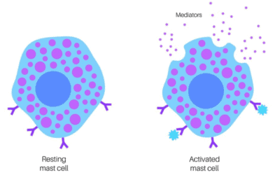 MCAS and Long Covid: The Connection & Treatment Options