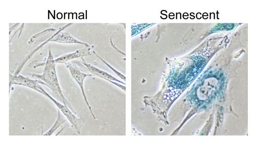 An image showing normal cells versus senescent cells under a microscope